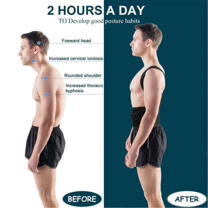 Back Brace Posture Corrector for Women & Men | Back Straightener, Scoliosis and Hunchback Correction,Adjustable Posture Trainer