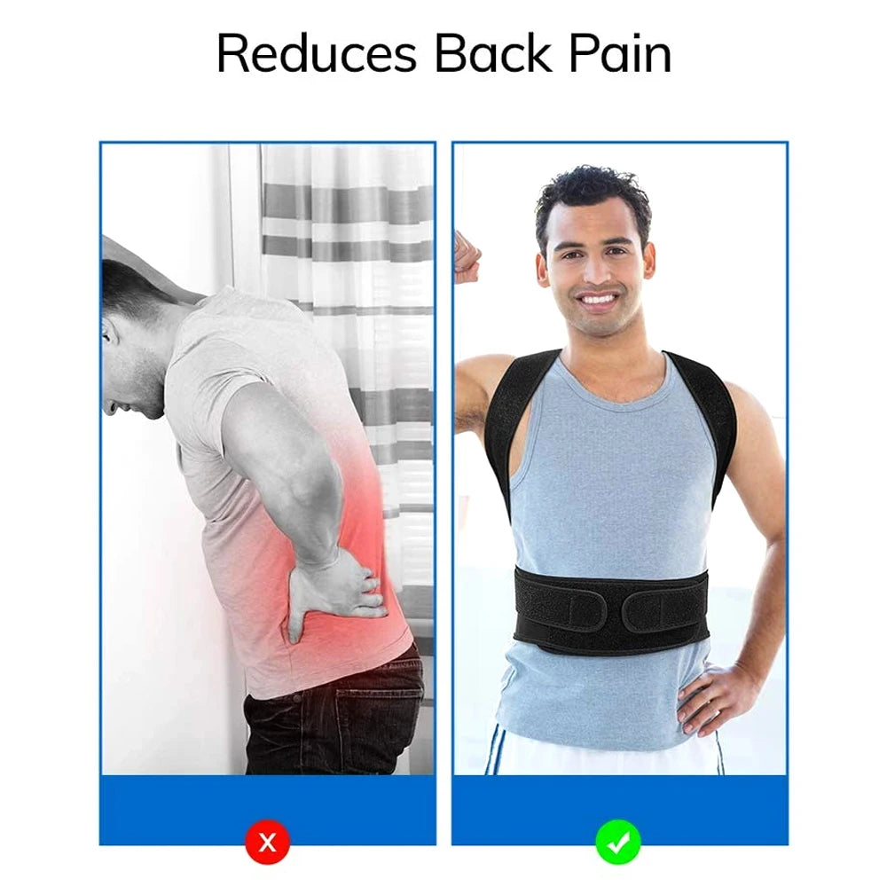 Back Brace Posture Corrector for Women & Men | Back Straightener, Scoliosis and Hunchback Correction,Adjustable Posture Trainer